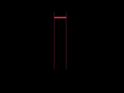 800px-ECG-PQRSkomplexT.svg.png