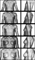 breasttanner