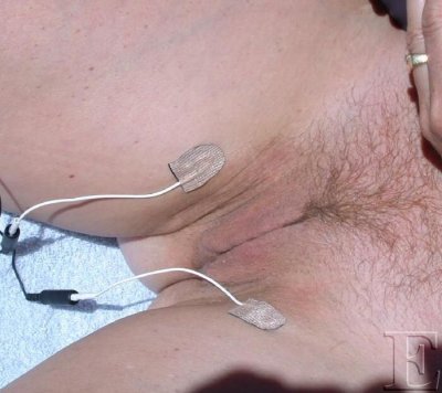 stim02