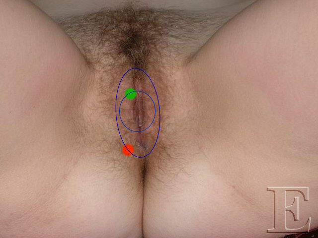 bulbospong3