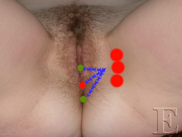 trans_peri_asym trans_peri_asym